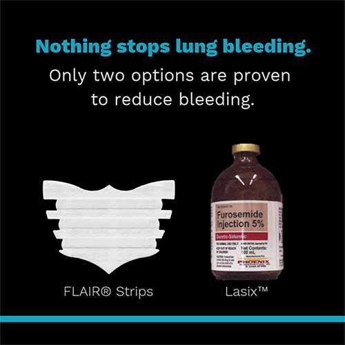 FLAIR® Nasal Strips